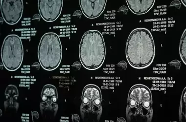 Brain Structure, Narcissistic Traits, and Emotion Regulation: A New Study