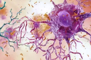 Alzheimer's Disease: Peripheral Symptoms Discovered Beyond the Brain