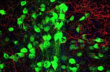 New Brain Pathway Links Tourette's and OCD