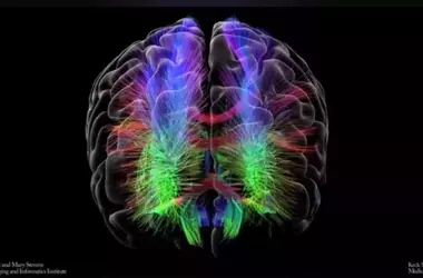 Bipolar Disorder and Brain Connectivity