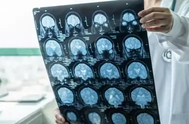 Brain Scan Study Uncovers Physical Foundations of PTSD's Intrusive Symptoms