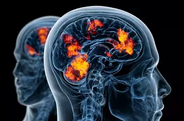 Precision Brain Imaging Boosts Depression Treatment Efficacy
