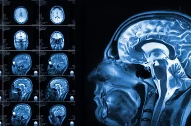Childhood Brain Network Patterns Predict Early Adolescent Alcohol Use