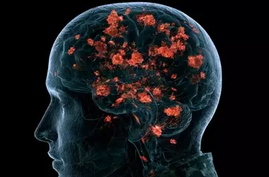 Immune Protein Provides Brain Protection Against Depression and PTSD After TBI