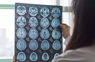 Early Brain Changes in Alzheimer's Disease: A Precursor to Amyloid Plaques