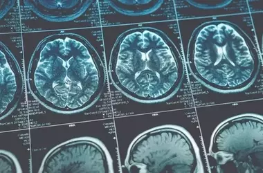 Divergent Brain Responses to Reward in ADHD and Autism Revealed by Advanced Imaging